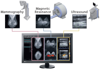 FDA 510(k) Clearance Multi-Modality Image Display